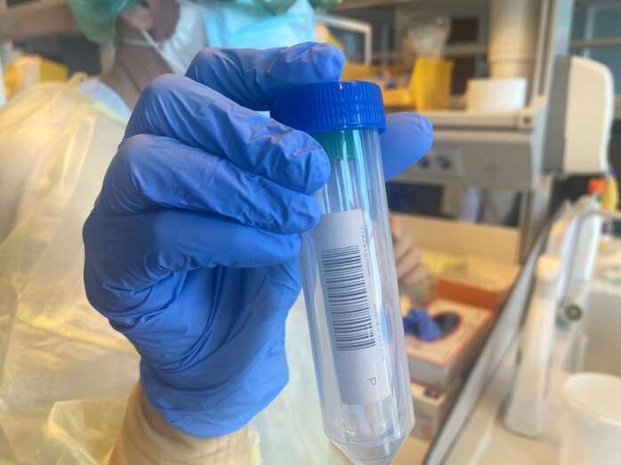 Imagen de una muestra para PCR / TA